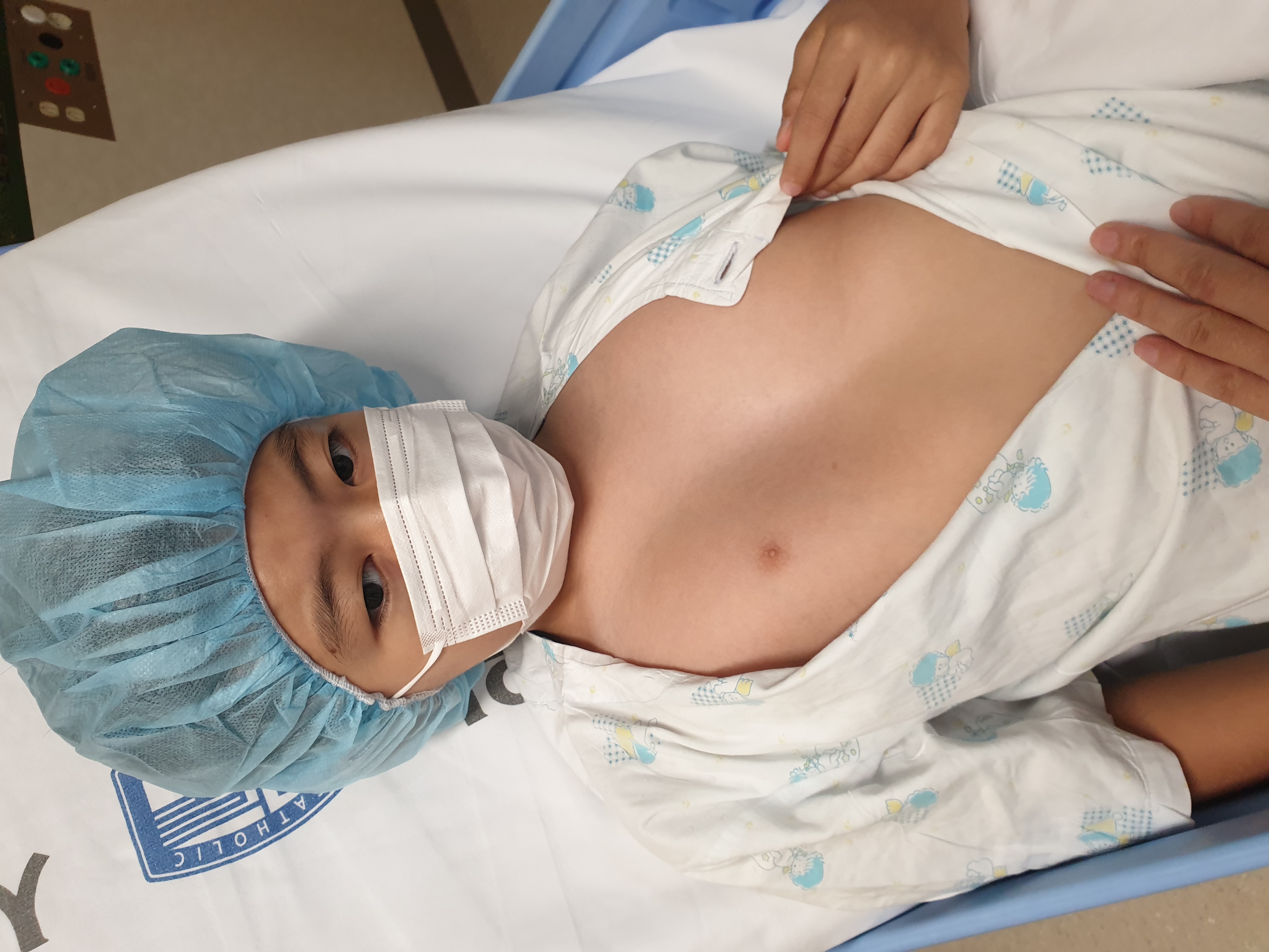 A photo representing Pectus Excavatum corrective surgery and recovery.